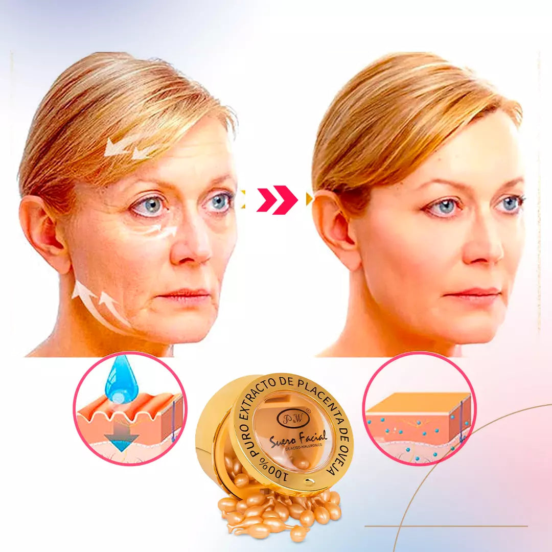 SUERO FACIAL ANTI EDAD CON EXTRACTO DE PLACENTA DE OVEJA Y ÁCIDO HIALURÓNICO